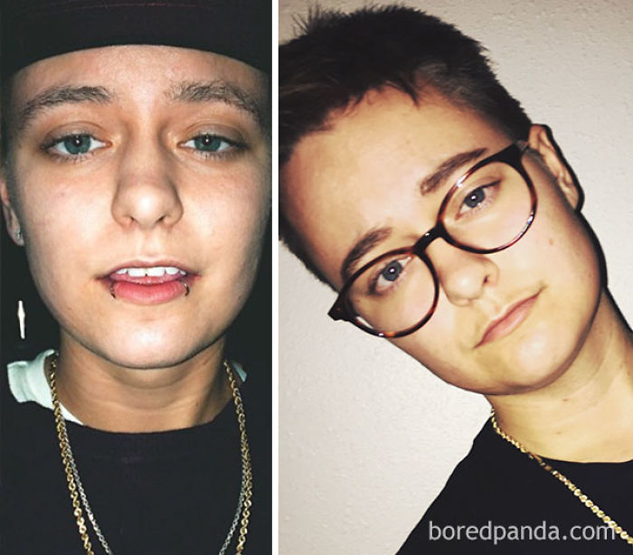 65 Before-And-After Pics Show What Happens When You Stop Drinking (Part 2)