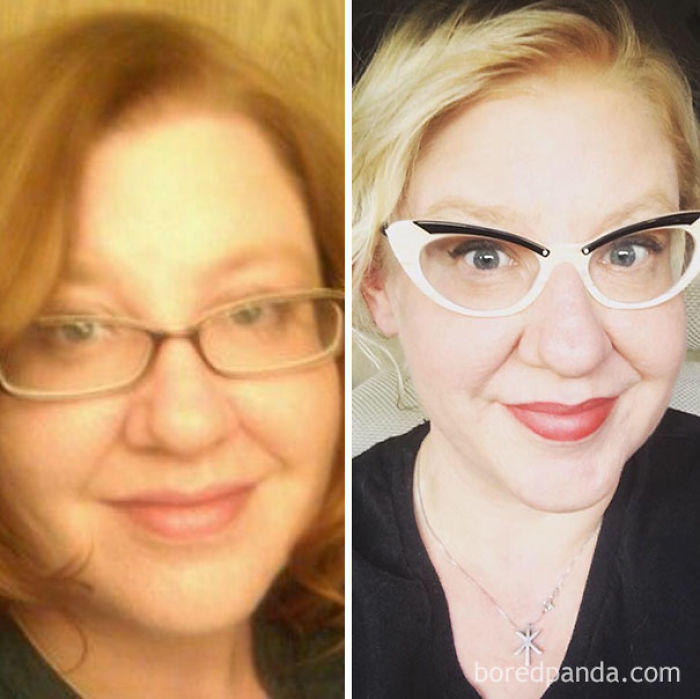 65 Before-And-After Pics Show What Happens When You Stop Drinking (Part 2)