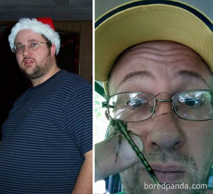 65 Before-And-After Pics Show What Happens When You Stop Drinking (Part 2)