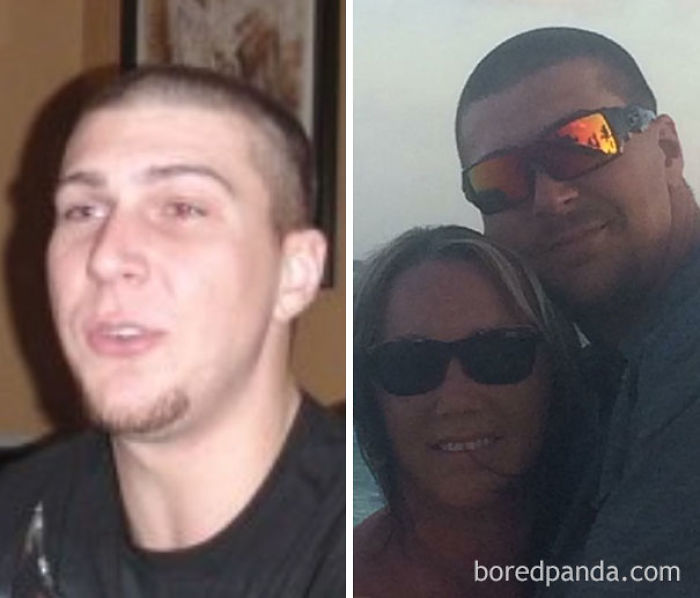 65 Before-And-After Pics Show What Happens When You Stop Drinking (Part 2)