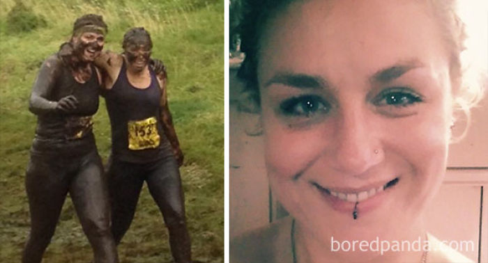 65 Before-And-After Pics Show What Happens When You Stop Drinking (Part 2)