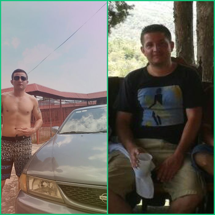 65 Before-And-After Pics Show What Happens When You Stop Drinking (Part 2)