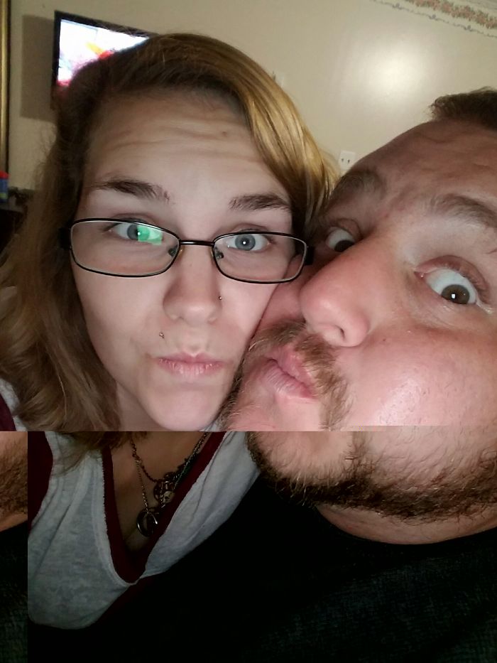 65 Before-And-After Pics Show What Happens When You Stop Drinking (Part 2)