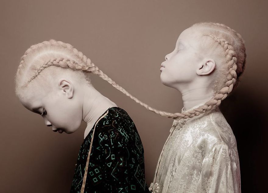 Albino Twins From Brazil Are Taking The Fashion Industry By Storm With Their Unique Beauty Albino Twins From Brazil Are Taking The Fashion Industry By Storm With Their Unique Beauty