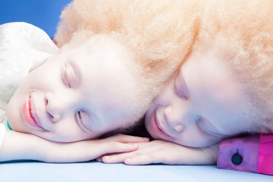Albino Twins From Brazil Are Taking The Fashion Industry By Storm With Their Unique Beauty Albino Twins From Brazil Are Taking The Fashion Industry By Storm With Their Unique Beauty