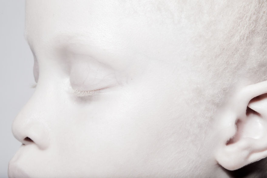 Albino Twins From Brazil Are Taking The Fashion Industry By Storm With Their Unique Beauty Albino Twins From Brazil Are Taking The Fashion Industry By Storm With Their Unique Beauty