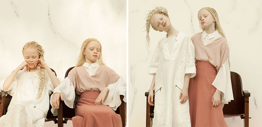 Albino Twins From Brazil Are Taking The Fashion Industry By Storm With Their Unique Beauty Albino Twins From Brazil Are Taking The Fashion Industry By Storm With Their Unique Beauty