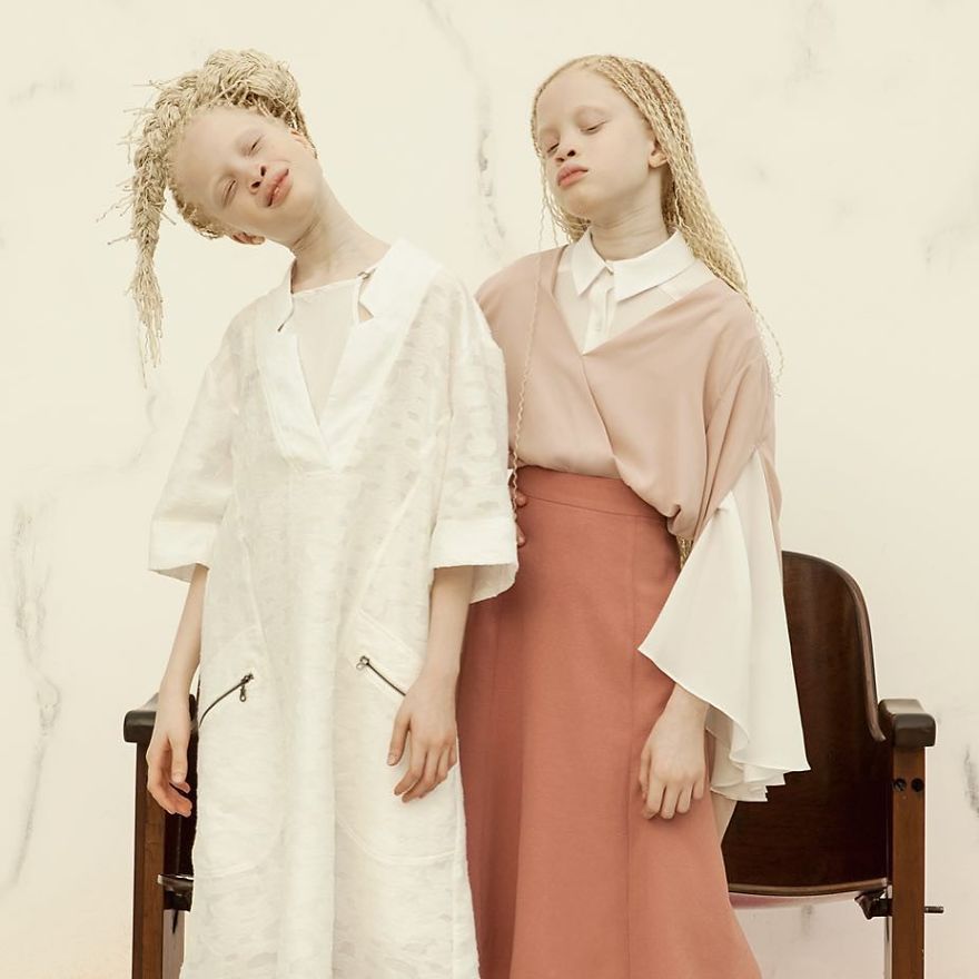 Albino Twins From Brazil Are Taking The Fashion Industry By Storm With Their Unique Beauty Albino Twins From Brazil Are Taking The Fashion Industry By Storm With Their Unique Beauty