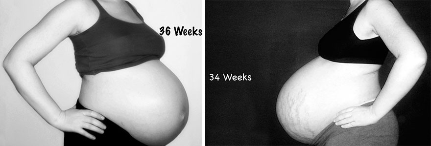 Side By Side Comparison Of My Singleton Pregnancy And My Twin Pregnancy
