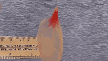 Scientists Transform Spinach Leaves Into Working Human Heart Tissue