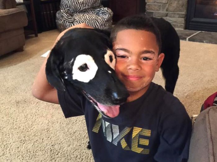 Boy With A Rare Skin Disorder Hates His Looks, Until He Meets His Dog Twin Boy With A Rare Skin Disorder Hates His Looks, Until He Meets His Dog Twin