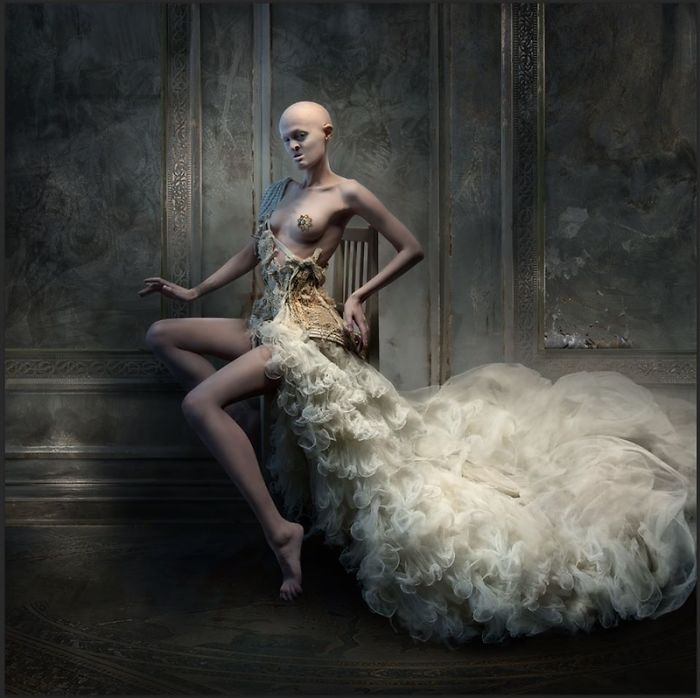 Meet Melanie Gaydos, 28-Year-Old Model With A Rare Genetic Disorder Who Broke All Fashion Stereotypes