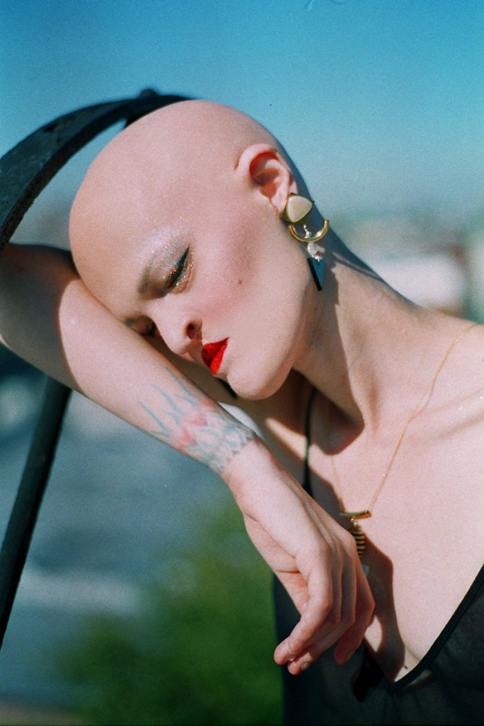 Meet Melanie Gaydos, 28-Year-Old Model With A Rare Genetic Disorder Who Broke All Fashion Stereotypes