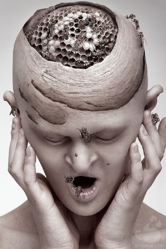 Meet Melanie Gaydos, 28-Year-Old Model With A Rare Genetic Disorder Who Broke All Fashion Stereotypes