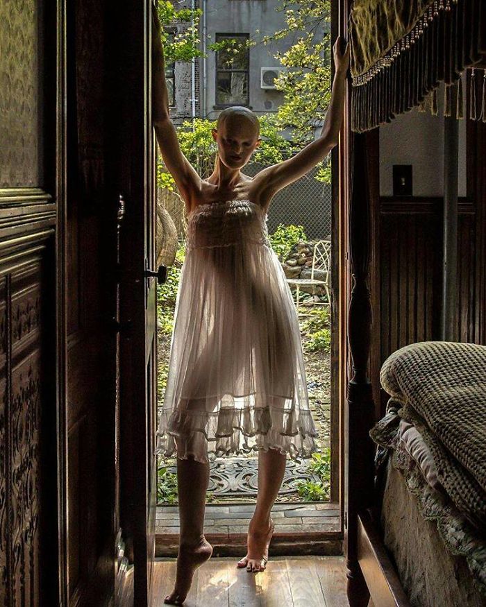 Meet Melanie Gaydos, 28-Year-Old Model With A Rare Genetic Disorder Who Broke All Fashion Stereotypes