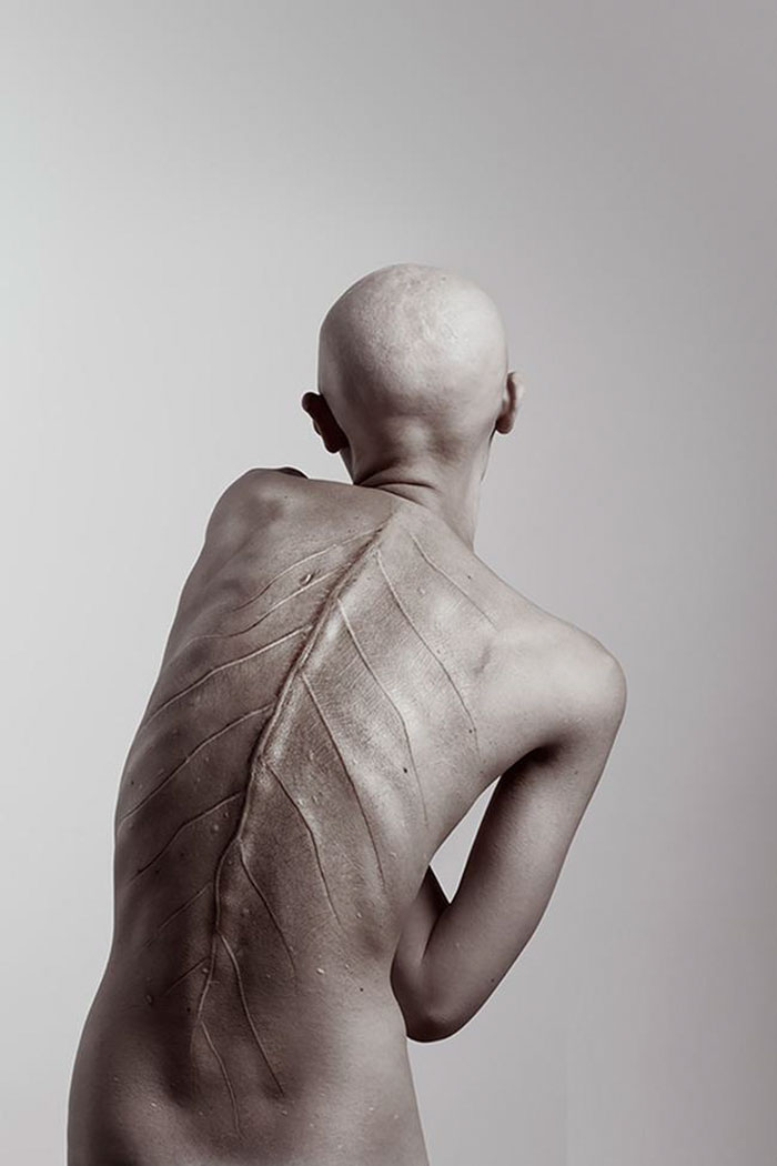 Meet Melanie Gaydos, 28-Year-Old Model With A Rare Genetic Disorder Who Broke All Fashion Stereotypes