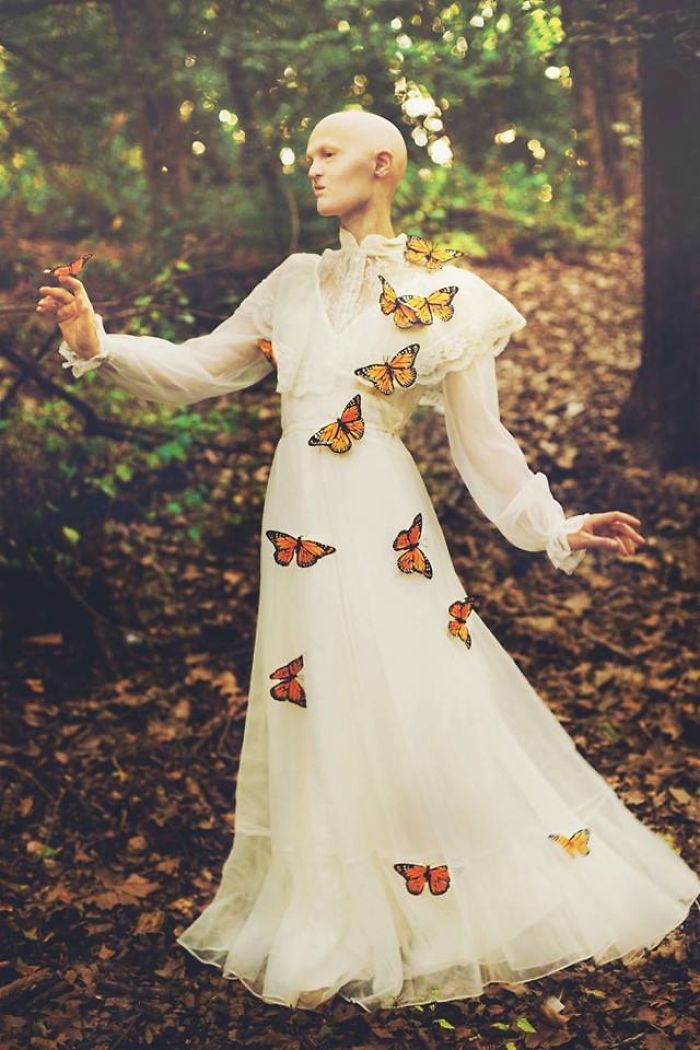 Meet Melanie Gaydos, 28-Year-Old Model With A Rare Genetic Disorder Who Broke All Fashion Stereotypes