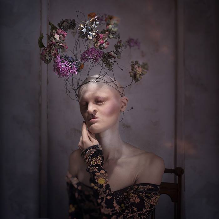 Meet Melanie Gaydos, 28-Year-Old Model With A Rare Genetic Disorder Who Broke All Fashion Stereotypes