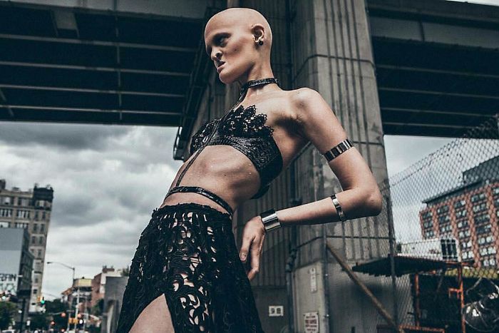 Meet Melanie Gaydos, 28-Year-Old Model With A Rare Genetic Disorder Who Broke All Fashion Stereotypes