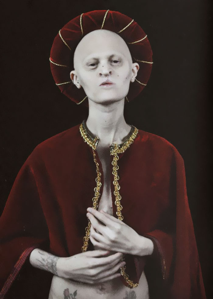 Meet Melanie Gaydos, 28-Year-Old Model With A Rare Genetic Disorder Who Broke All Fashion Stereotypes