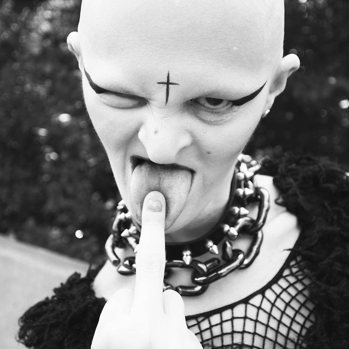 Meet Melanie Gaydos, 28-Year-Old Model With A Rare Genetic Disorder Who Broke All Fashion Stereotypes