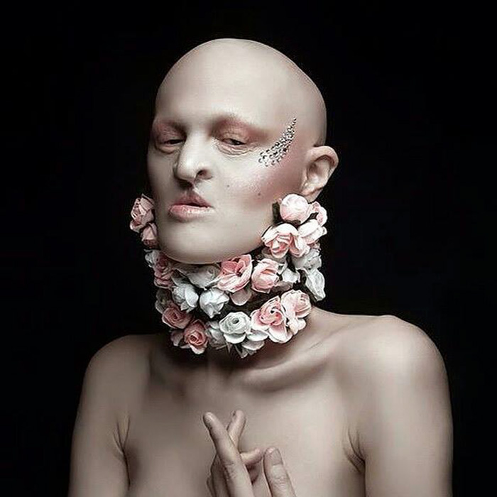 Meet Melanie Gaydos, 28-Year-Old Model With A Rare Genetic Disorder Who Broke All Fashion Stereotypes