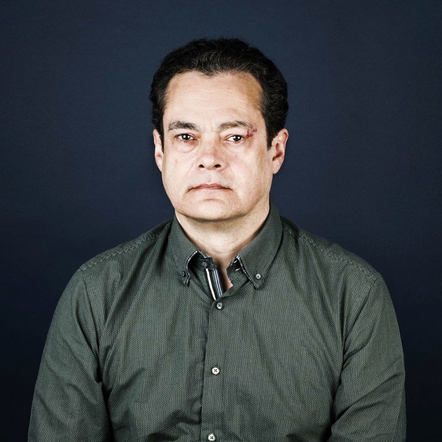 19 Portraits Of People With Birthmarks That Might Change The Way You See Them