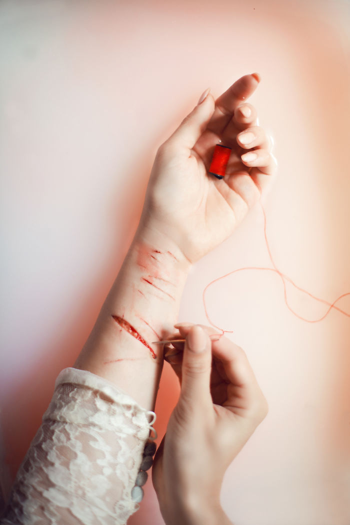 I Contracted Spinal Viral Meningitis After A Photoshoot In A Swamp, And This Art Series Capture My Battle Against It (NSFW)