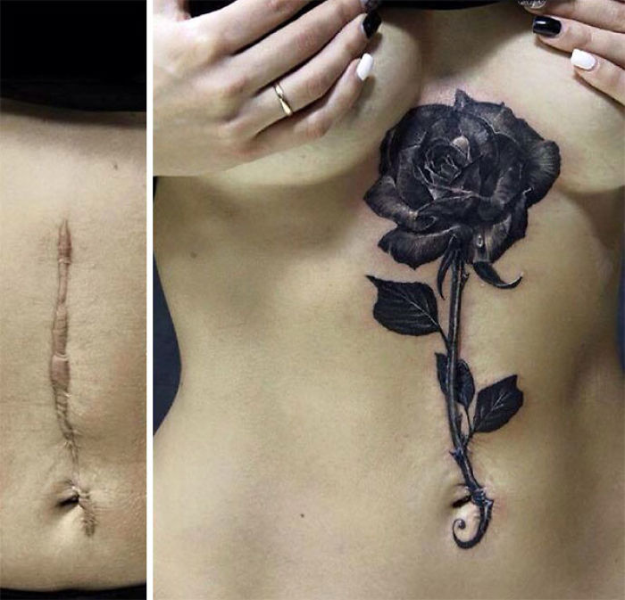 211 Amazing Tattoos That Turn Scars Into Works Of Art 211 Amazing Tattoos That Turn Scars Into Works Of Art