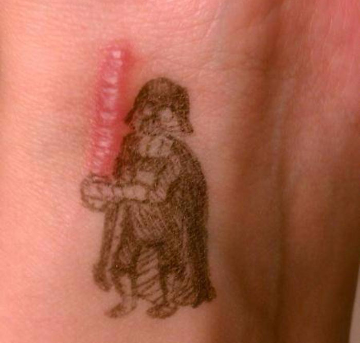 211 Amazing Tattoos That Turn Scars Into Works Of Art 211 Amazing Tattoos That Turn Scars Into Works Of Art
