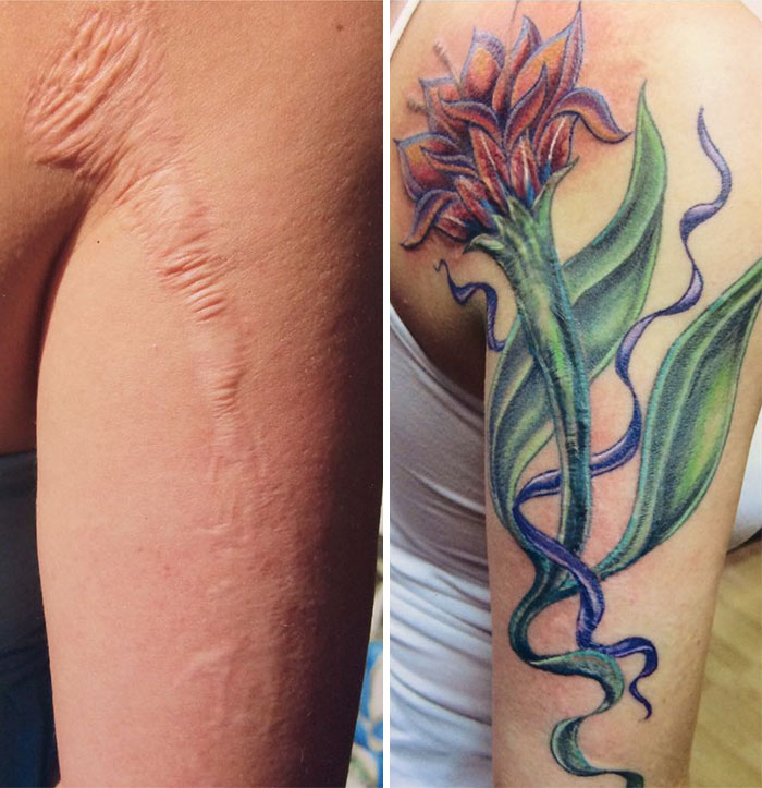 211 Amazing Tattoos That Turn Scars Into Works Of Art 211 Amazing Tattoos That Turn Scars Into Works Of Art
