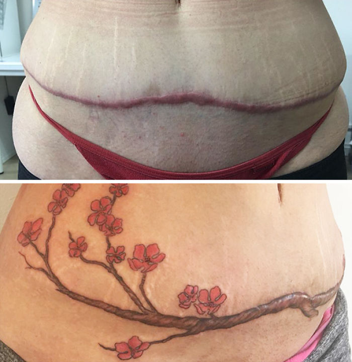 211 Amazing Tattoos That Turn Scars Into Works Of Art 211 Amazing Tattoos That Turn Scars Into Works Of Art