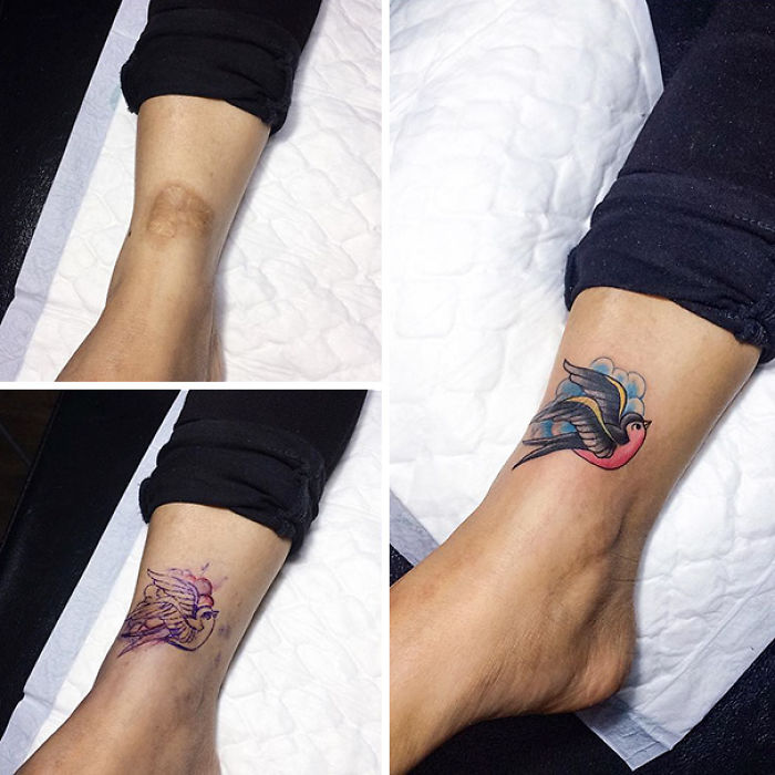 211 Amazing Tattoos That Turn Scars Into Works Of Art 211 Amazing Tattoos That Turn Scars Into Works Of Art