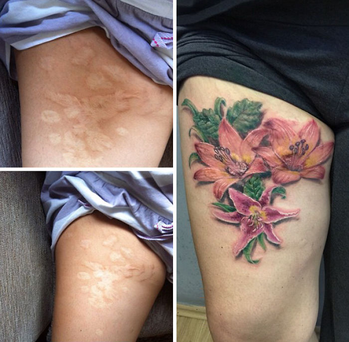 211 Amazing Tattoos That Turn Scars Into Works Of Art 211 Amazing Tattoos That Turn Scars Into Works Of Art