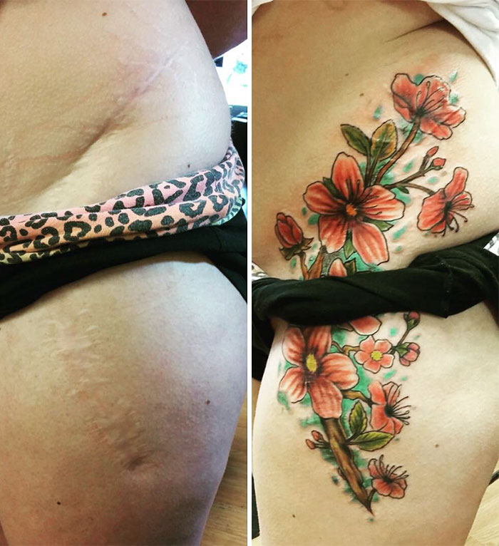 211 Amazing Tattoos That Turn Scars Into Works Of Art 211 Amazing Tattoos That Turn Scars Into Works Of Art