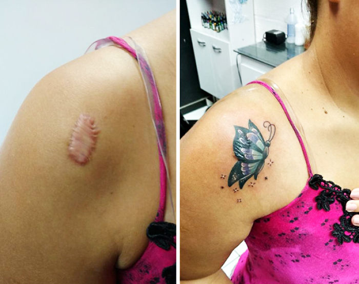 211 Amazing Tattoos That Turn Scars Into Works Of Art 211 Amazing Tattoos That Turn Scars Into Works Of Art
