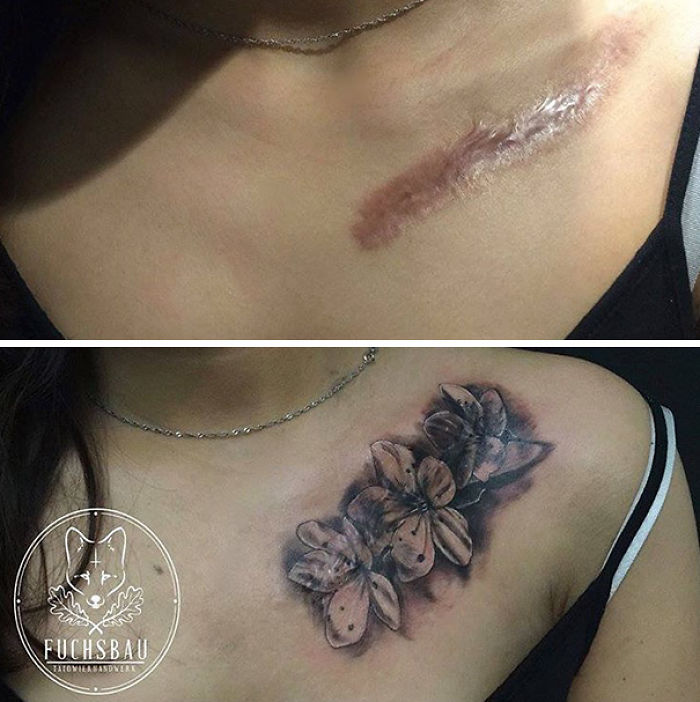 211 Amazing Tattoos That Turn Scars Into Works Of Art 211 Amazing Tattoos That Turn Scars Into Works Of Art