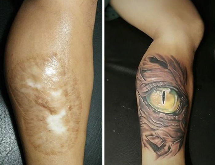 211 Amazing Tattoos That Turn Scars Into Works Of Art 211 Amazing Tattoos That Turn Scars Into Works Of Art