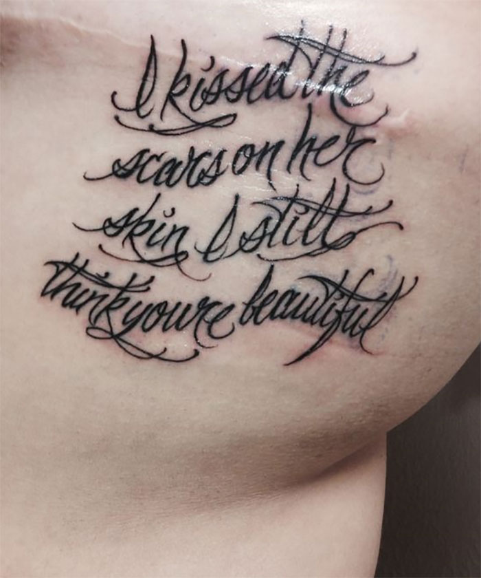 211 Amazing Tattoos That Turn Scars Into Works Of Art 211 Amazing Tattoos That Turn Scars Into Works Of Art