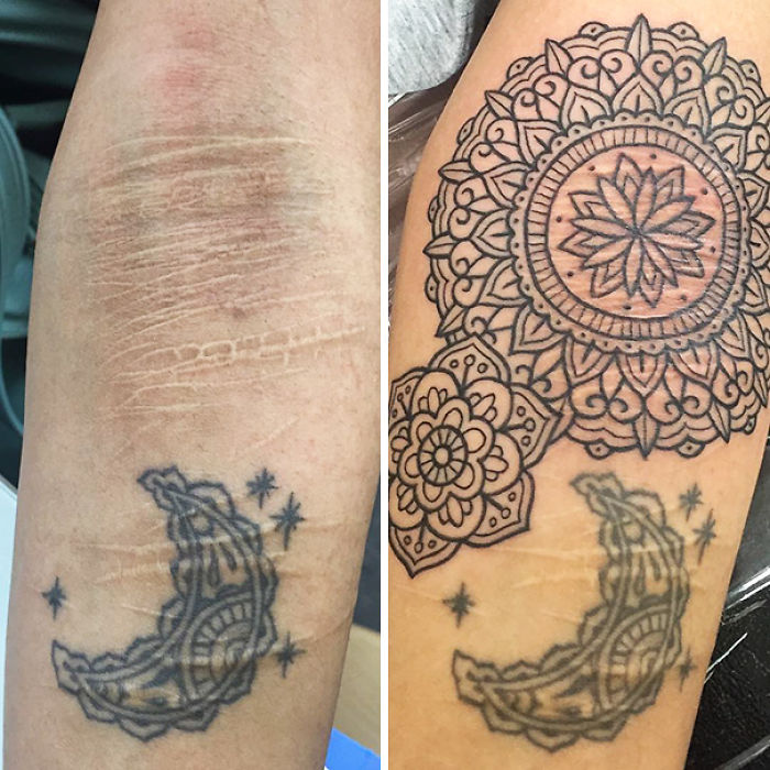 211 Amazing Tattoos That Turn Scars Into Works Of Art 211 Amazing Tattoos That Turn Scars Into Works Of Art