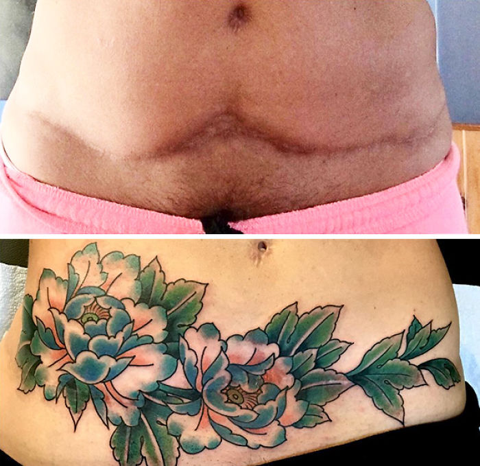 211 Amazing Tattoos That Turn Scars Into Works Of Art 211 Amazing Tattoos That Turn Scars Into Works Of Art