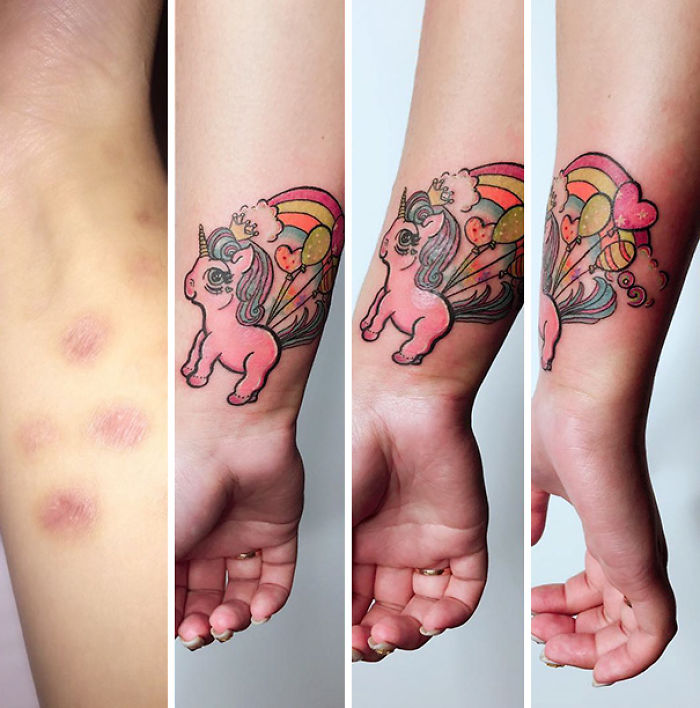 211 Amazing Tattoos That Turn Scars Into Works Of Art 211 Amazing Tattoos That Turn Scars Into Works Of Art