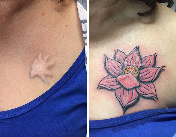 211 Amazing Tattoos That Turn Scars Into Works Of Art 211 Amazing Tattoos That Turn Scars Into Works Of Art