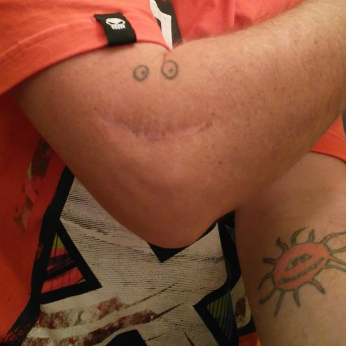 211 Amazing Tattoos That Turn Scars Into Works Of Art 211 Amazing Tattoos That Turn Scars Into Works Of Art