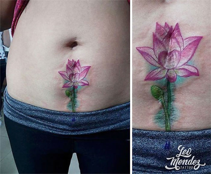 211 Amazing Tattoos That Turn Scars Into Works Of Art 211 Amazing Tattoos That Turn Scars Into Works Of Art