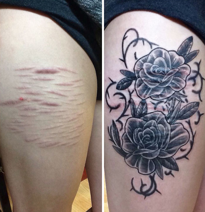 211 Amazing Tattoos That Turn Scars Into Works Of Art 211 Amazing Tattoos That Turn Scars Into Works Of Art