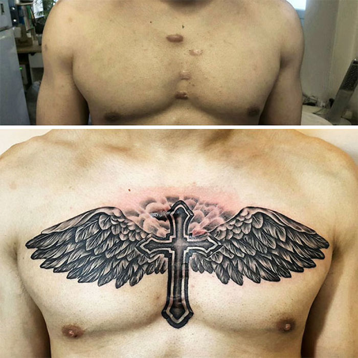 211 Amazing Tattoos That Turn Scars Into Works Of Art 211 Amazing Tattoos That Turn Scars Into Works Of Art