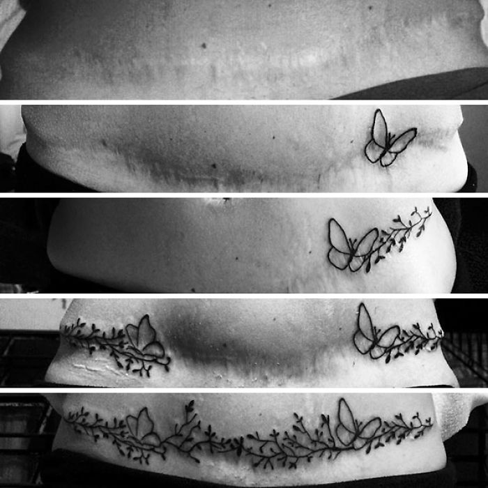 211 Amazing Tattoos That Turn Scars Into Works Of Art 211 Amazing Tattoos That Turn Scars Into Works Of Art