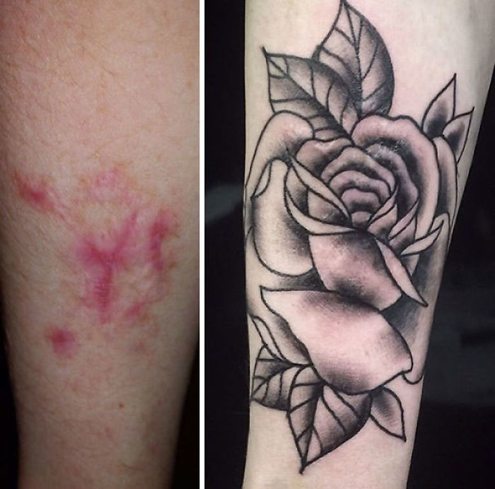 211 Amazing Tattoos That Turn Scars Into Works Of Art 211 Amazing Tattoos That Turn Scars Into Works Of Art
