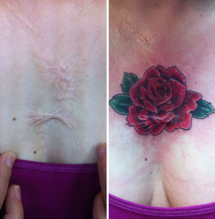 211 Amazing Tattoos That Turn Scars Into Works Of Art 211 Amazing Tattoos That Turn Scars Into Works Of Art